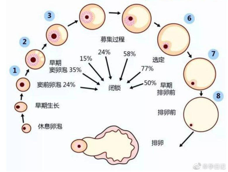 多囊卵巢综合征