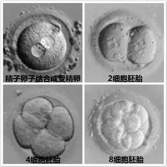 多囊卵巢综合征