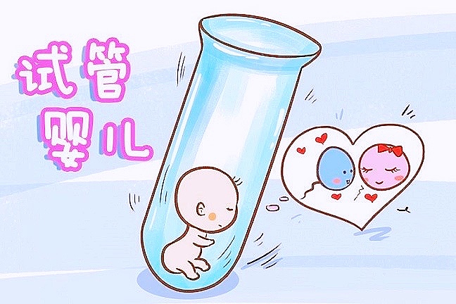 多囊卵巢综合征