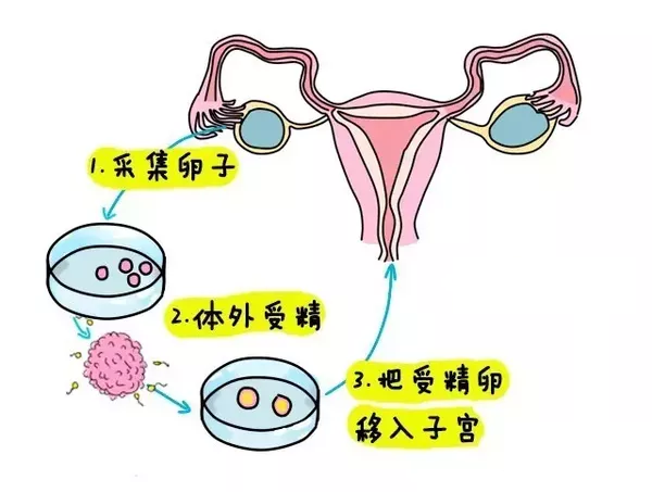 对着宫口直拍