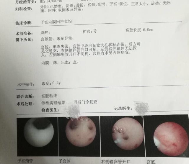 备孕臀位垫高