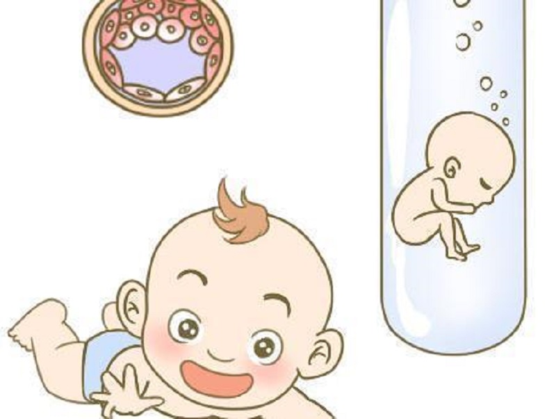 多囊卵巢综合征