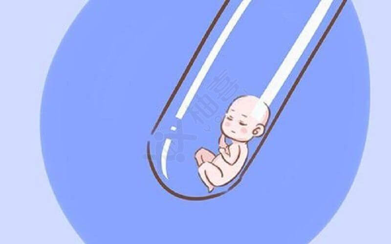 多囊卵巢综合征