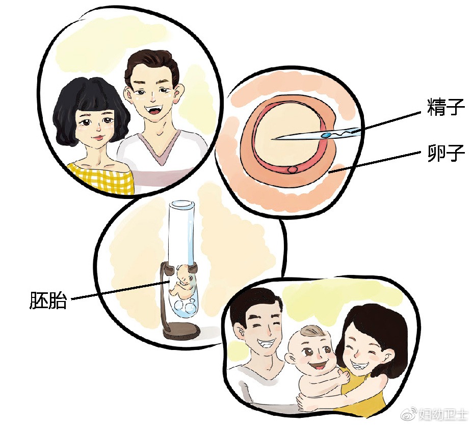 多囊受精卵