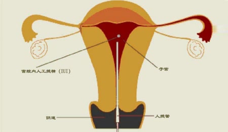 备孕躺