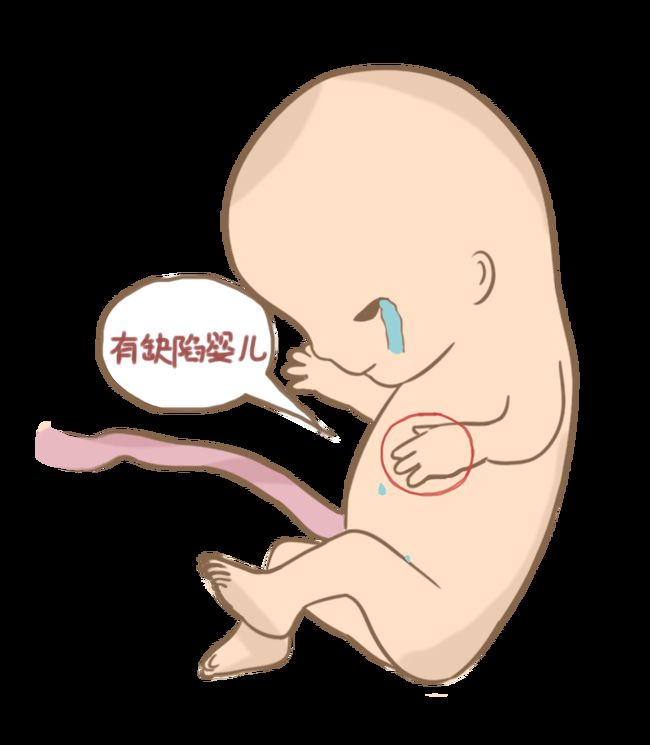 多囊卵巢综合征
