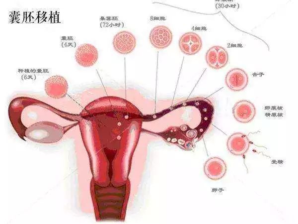 多囊卵巢综合征
