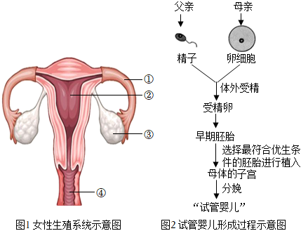 贵阳试管婴儿