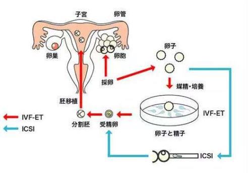 娄底捐卵机构公司