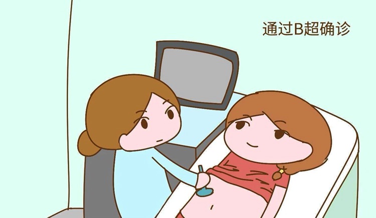 捐卵广告
