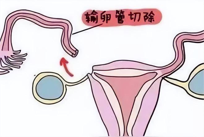 婴儿音乐0-3个月钢琴曲
