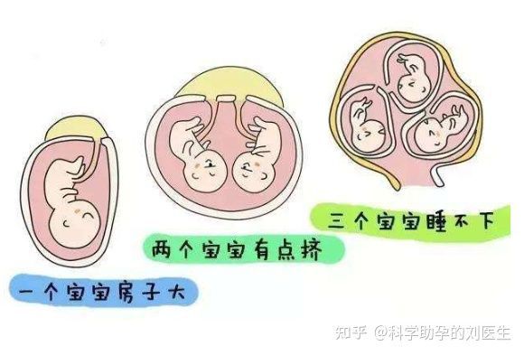 女性绝育