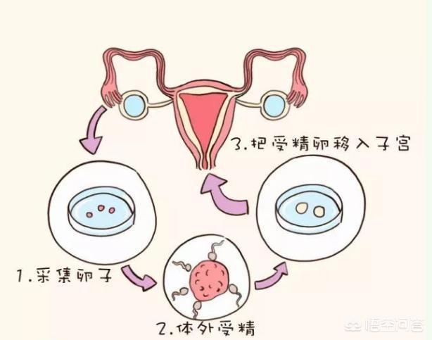 绝经
