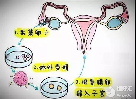 威海招聘捐卵女孩机构